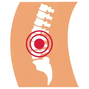 cadera (2) cadera (2)