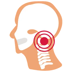 descompresión cervical Cirugía de Columna en Cuernavaca