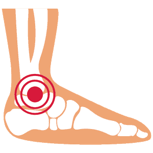 tobillo y pie tobillo y pie