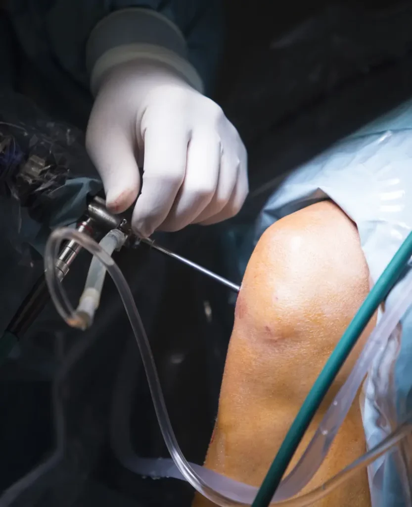 doctor para artroscopia