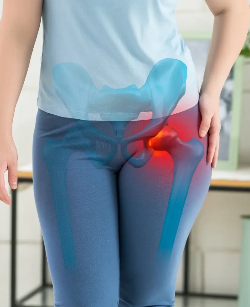 especialista en cadera