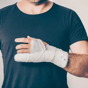 fracturas y luxaciones cuernavaca fracturas y luxaciones cuernavaca