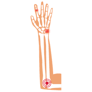 muñeca y mano muñeca y mano